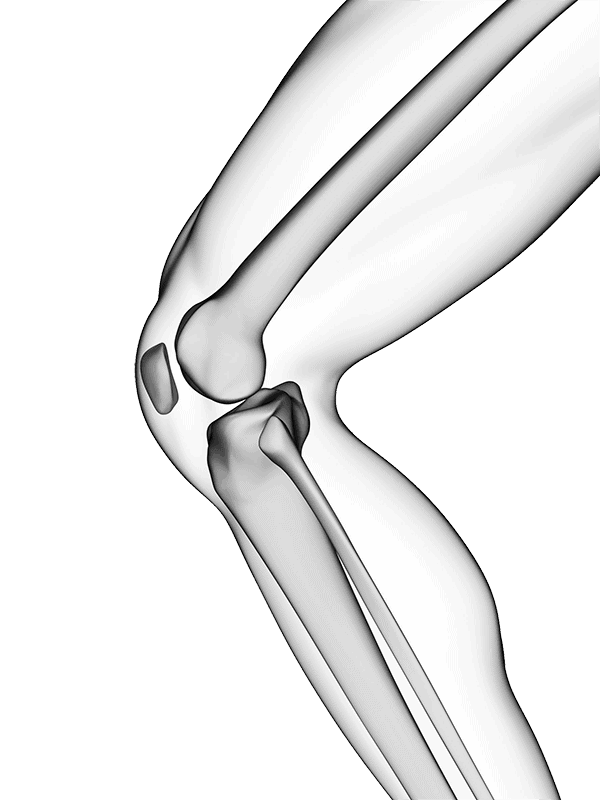 X-ray knee
