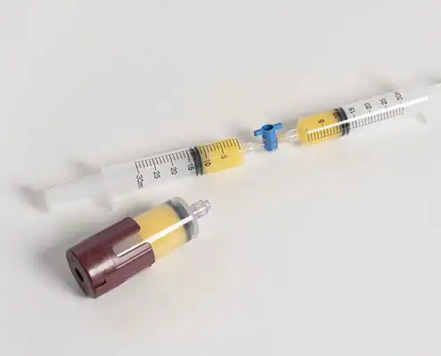 Lipo-Pro device kit Medical syringe with yellow medication and attached vial, used for precise drug delivery in medical settings.