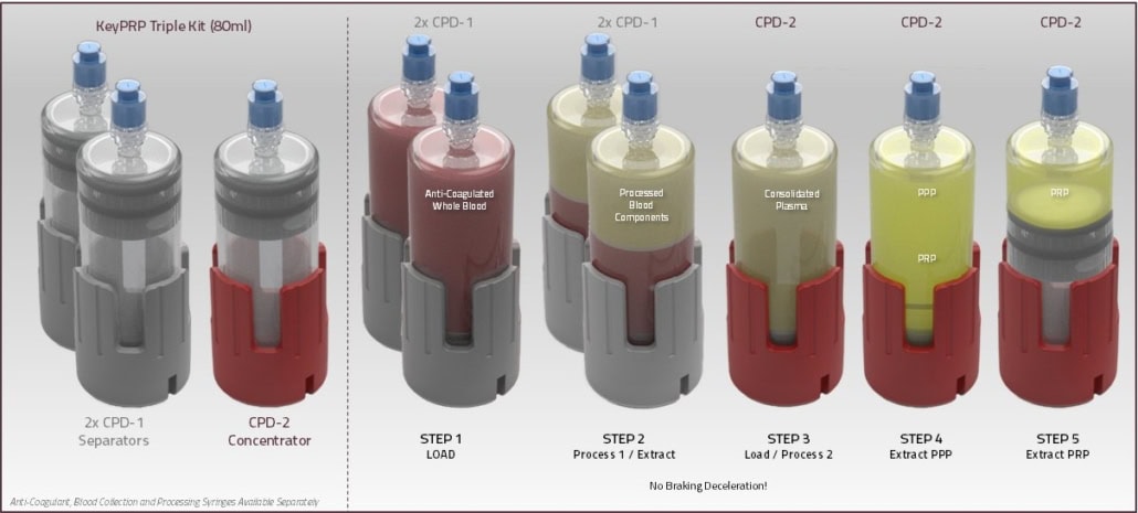 KeyPRP TRIPLE process overview